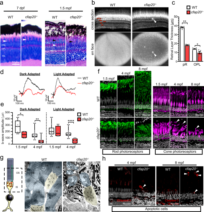 The inner junction protein CFAP20 functions in motile and non-motile cilia  and is critical for vision