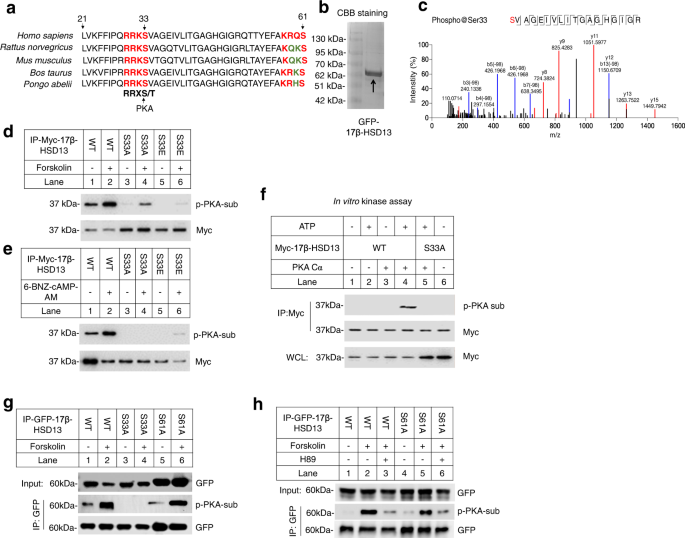 Phosphorylation of 17β-hydroxysteroid dehydrogenase 13 at serine 33 attenuates nonalcoholic fatty liver disease in mice