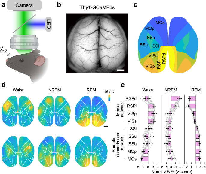 REM sleep is associated with distinct global cortical dynamics and  controlled by occipital cortex