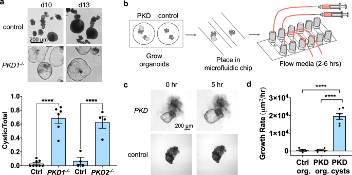 Glucose absorption drives cystogenesis in a human organoid-on-chip model of  polycystic kidney disease | Nature Communications