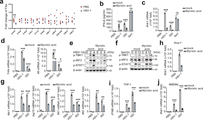 Myristic acid as a checkpoint to regulate STING-dependent autophagy and  interferon responses by promoting N-myristoylation | Nature Communications