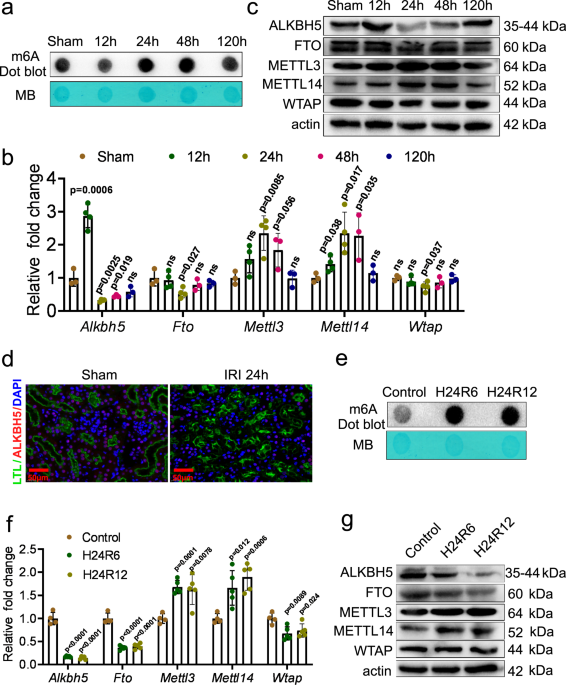 Inhibition of ALKBH5 attenuates I/R-induced renal injury in male 