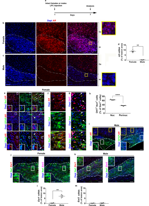 Androgens show sex-dependent differences in myelination in immune and non-immune murine models of cns demyelination