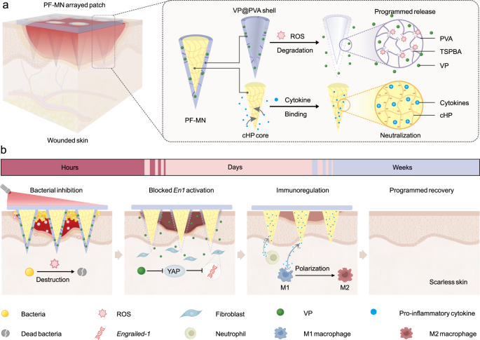 Scarless wound healing programmed by core-shell microneedles | Nature  Communications