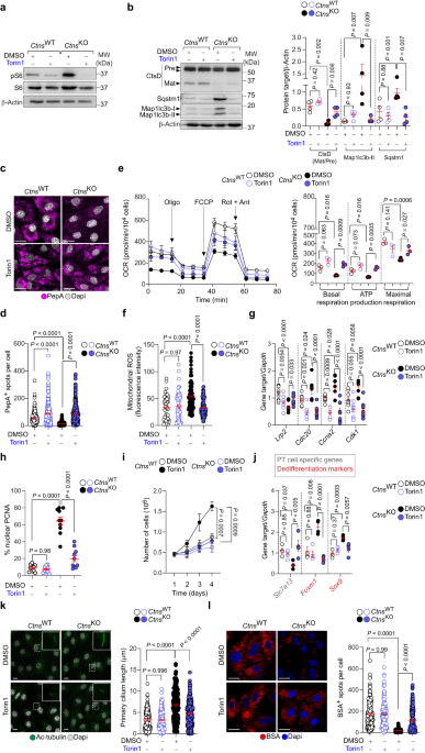 Lysosomal cystine export regulates mTORC1 signaling to guide kidney  epithelial cell fate specialization