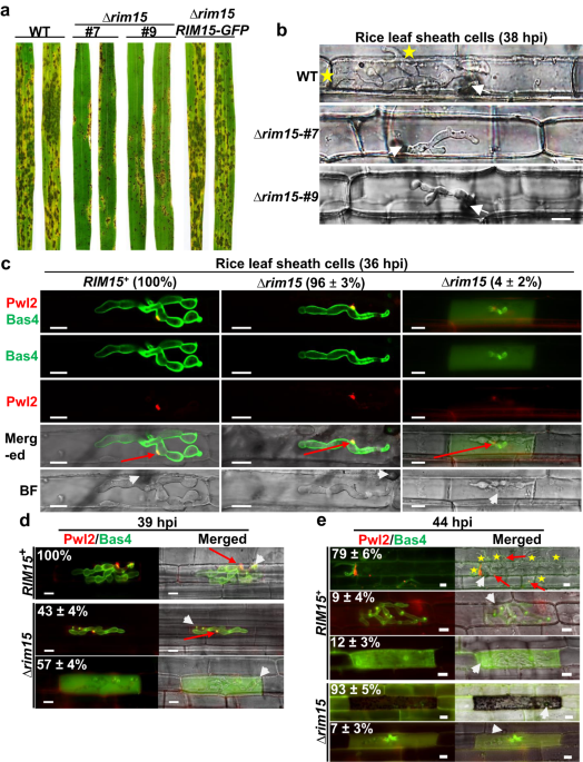 A protein kinase coordinates cycles of autophagy and glutaminolysis in  invasive hyphae of the fungus Magnaporthe oryzae within rice cells