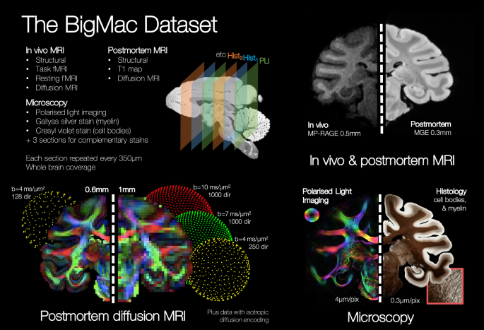 An open resource combining multi-contrast MRI and microscopy in ... - Nature.com