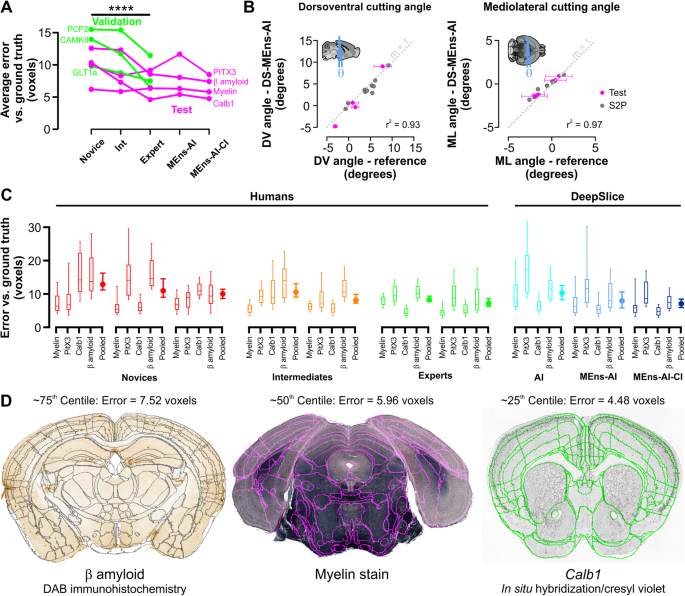 DeepSlice: rapid fully automatic registration of mouse brain imaging to a  volumetric atlas