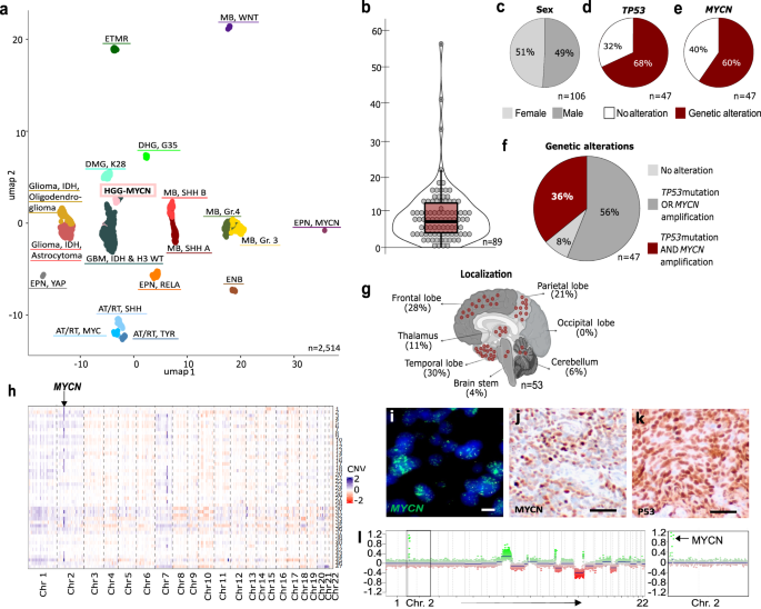 Mouse models of pediatric high grade gliomas with MYCN  