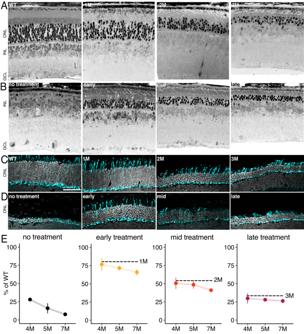Late gene therapy limits the restoration of retinal function in a mouse model of retinitis pigmentosa