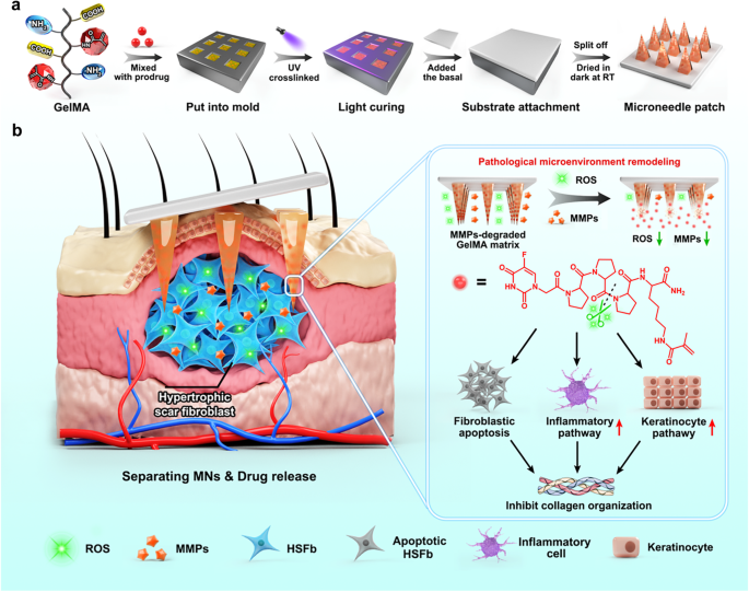 Endogenous stimuli-responsive separating microneedles to inhibit ...