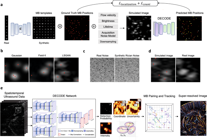 Context-aware deep learning enables high-efficacy localization of high concentration microbubbles for super-resolution ultrasound localization microscopy