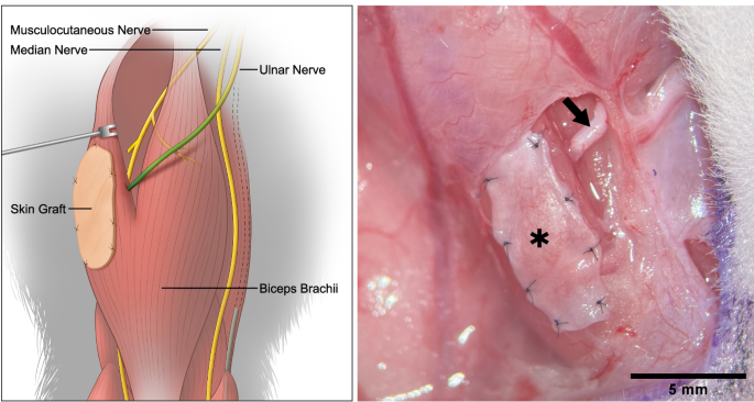 3B Anatomical Chart - Spinal Nerves 20 x 25in 3B Anatomical Chart - Spinal Nerves 20 x 25in