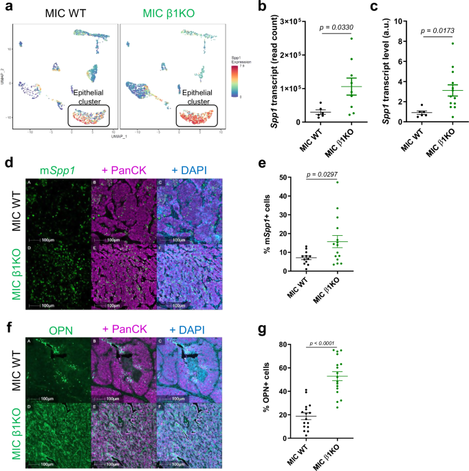 Osteopontin is a therapeutic target that drives breast cancer recurrence