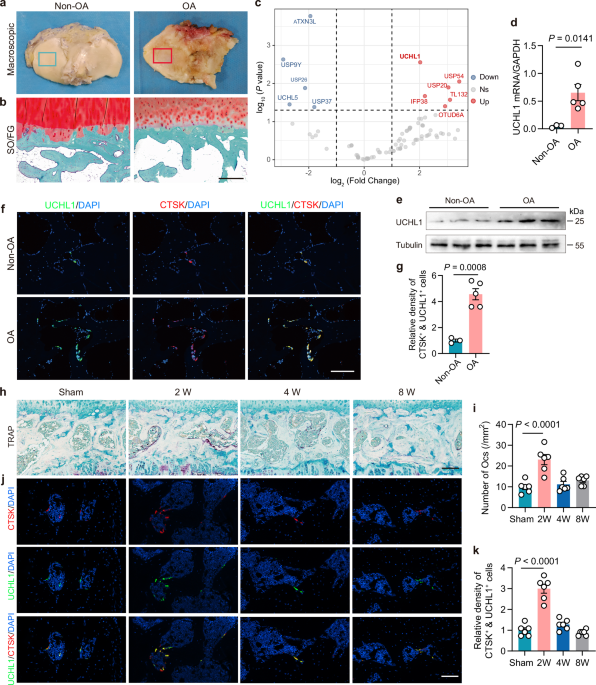 A rankl-uchl1-scd13 negative feedback loop limits osteoclastogenesis in subchondral bone to prevent osteoarthritis progression