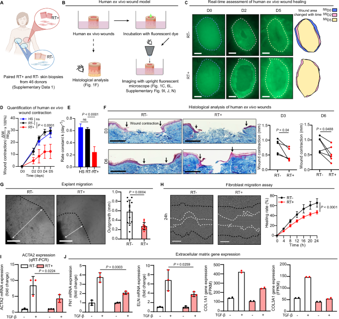 Epigenetic memory of radiotherapy in dermal fibroblasts impairs wound repair capacity in cancer survivors