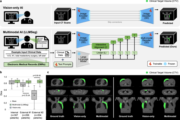 multimodal AI oncology - LLM-driven multimodal target volume contouring in radiation ...