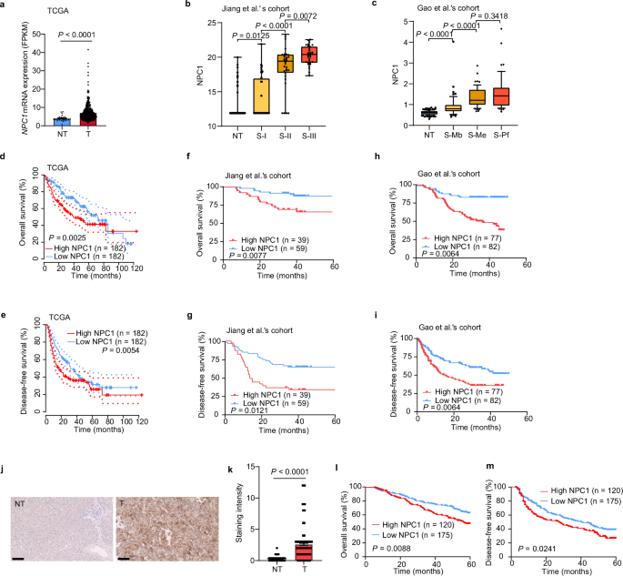 NPC1 controls TGFBR1 stability in a cholesterol transport-independent manner and promotes hepatocellular carcinoma progression