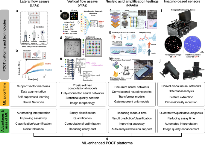 Machine learning in point-of-care testing: innovations, challenges, and opportunities Machine learning in point-of-care testing: innovations, challenges, and opportunities