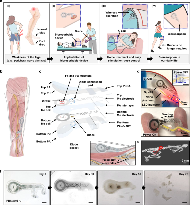 Bioresorbable, wireless dual stimulator for peripheral nerve ...