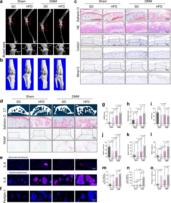 ipamorelin cortisol levels IPAMORELIN vs GHRP-2: Selectivity vs Potency Both stimulate growth hormone  release but through different mechanisms. IPAMORELIN: Pentapeptide sequence  Selective ghrelin mimetic Targets GH1a receptor specifically Minimal  cortisol effect Minimal