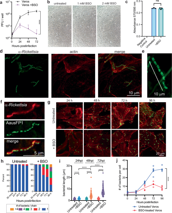 Host glutathione is required for Rickettsia parkeri cell division and intracellular survival | Nature Communications Host glutathione is required for Rickettsia parkeri cell division and intracellular survival | Nature Communications