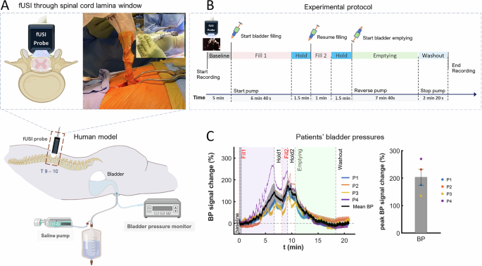 Human spinal cord activation during filling and emptying of the bladder