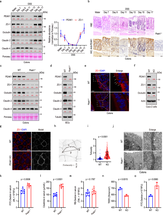 bpc-157 tight junction intestinal permeability study PEAK1 maintains tight junctions in intestinal epithelial cells and resists  colitis by inhibiting autophagy-mediated ZO-1 degradation