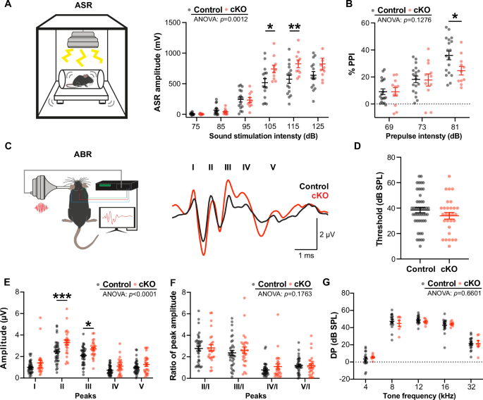 How Does Auditory Neuropathy Manifest in an ABR Test?