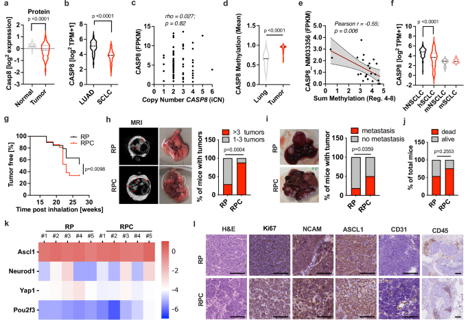 Lack of caspase 8 directs neuronal progenitor-like reprogramming and ...