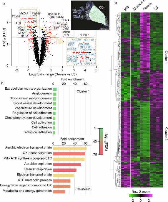 deficient glutathione connection to vaccine harm COVID19 adverse events: Evaluating the pathophysiology with an emphasis on sulfur metabolism and endotheliopathy - du Preez - 2024 - European Journal of Clinical Investigation mRNA therapeutics: Transforming medicine through