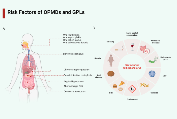 Probiotics and prebiotics: new treatment strategies for oral potentially  malignant disorders and gastrointestinal precancerous lesions | npj  Biofilms and Microbiomes
