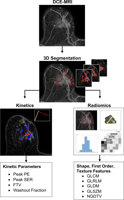 Preoperative tumor size measurement in breast cancer patients: which  threshold is appropriate on computer-aided detection for breast MRI?, Cancer Imaging