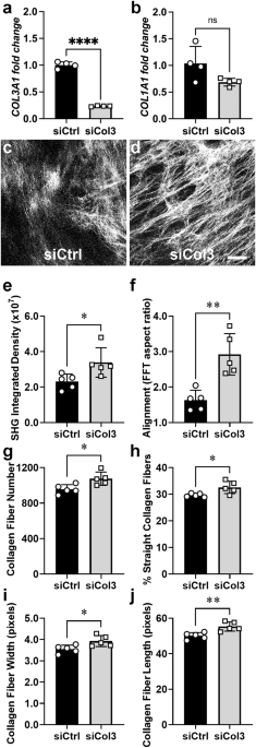 Prognostic and therapeutic implications of tumor-restrictive type III  collagen in the breast cancer microenvironment | npj Breast Cancer