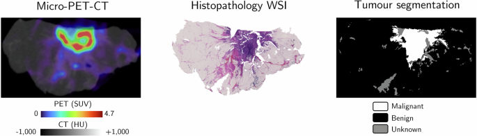 Enhancing Intraoperative Margin Evaluation with Deep Learning for Automatic Tumor Segmentation in Breast Lumpectomy Micro-PET-CT