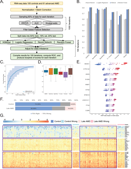 Uncovering Cell-Type Specific Immune Signatures in Macular Degeneration Through Explainable Machine Learning and Transcriptomics