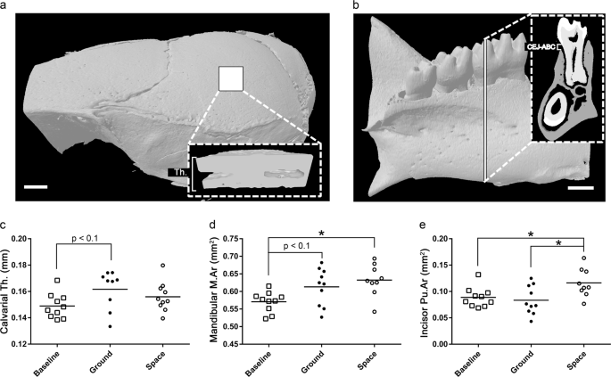 Skeletal Adaptations In Young Male Mice After 4 Weeks Aboard The International Space Station Npj Microgravity