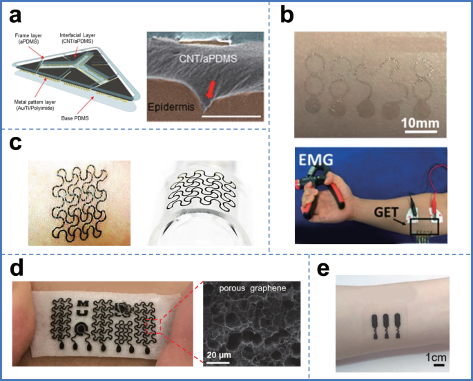 Recent advances in flexible noninvasive electrodes for surface