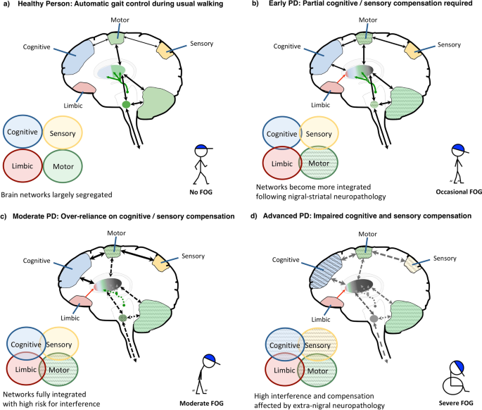 A Systematic Review On Exercise And Training Based Interventions For Freezing Of Gait In Parkinson S Disease Npj Parkinson S Disease