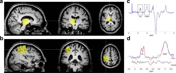 feature-image