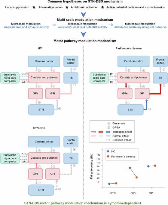 Push-pull effects of basal ganglia network in Parkinson’s disease ...