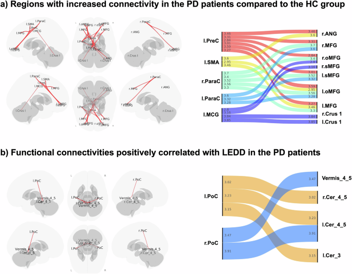 Altered habenular and whole brain functional connectivity in early ...