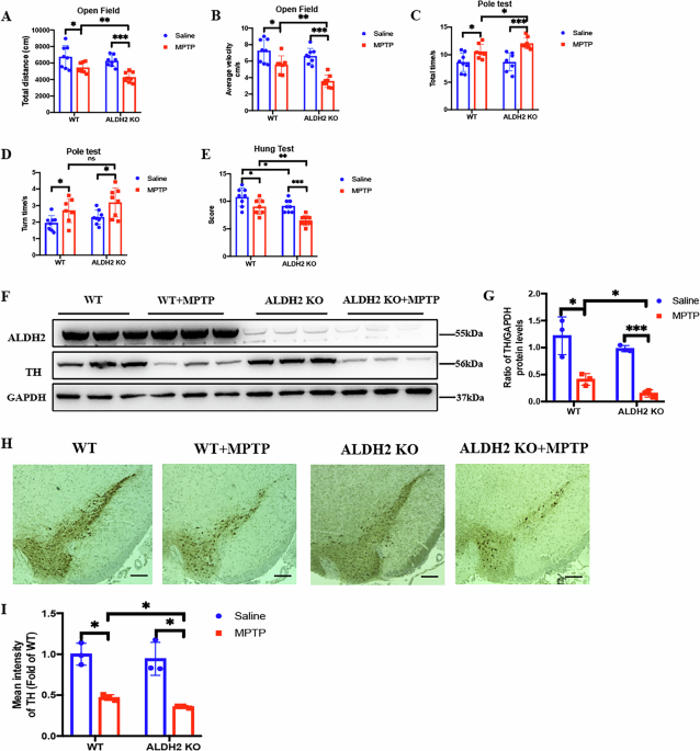 acetyl glutathione parkinson& 39 ALDH2 protects against dopaminergic neuronal cell ferroptosis by enhancing the enzyme activity of PRDX6 in Parkinson's disease oral