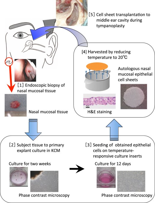 Middle ear mucosal regeneration by tissue-engineered cell sheet  transplantation | npj Regenerative Medicine