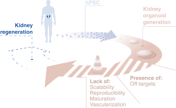 Overcoming Kidney Organoid Challenges For Regenerative Medicine Npj Regenerative Medicine