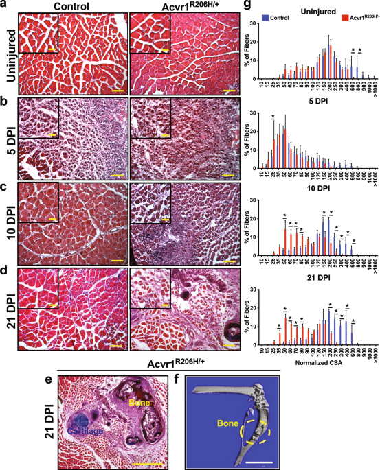 Dynamics of skeletal muscle-resident stem cells during myogenesis in fibrodysplasia ossificans progressiva