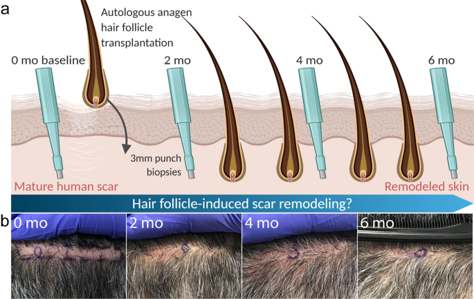 Pilot Study Supports Hair Revival Benefits  Isagenix Health