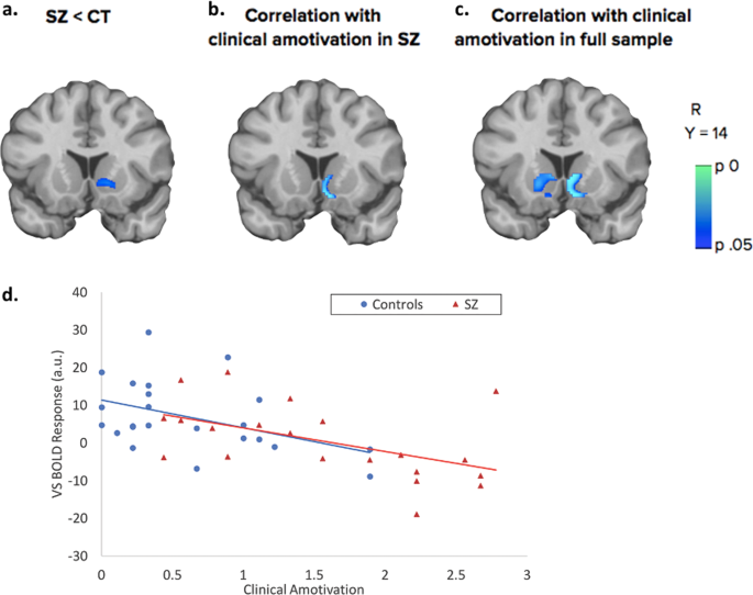 Relationship of ventral striatum activation during effort discounting to  clinical amotivation severity in schizophrenia | Schizophrenia