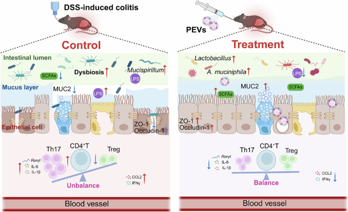 Faecalibacterium prausnitzii -derived extracellular vesicles ameliorate experimental colitis through regulating barrier immunity and gut microbiota – Nature