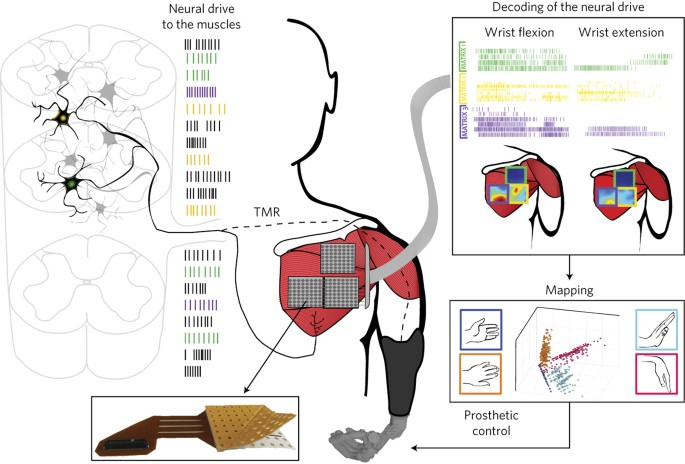 Man Machine Interface Based On The Discharge Timings Of Spinal Motor Neurons After Targeted Muscle Reinnervation Nature Biomedical Engineering